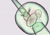 eizelle2 © Gunnar Assmy - Fotolia.com Kopie eizelle2 © Gunnar Assmy - Fotolia.com Kopie
